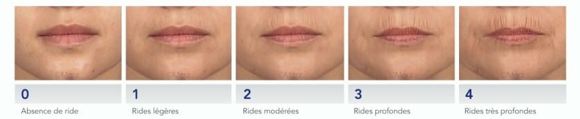 Nathan Yadun Center - Soins rides péribuccale Rouen