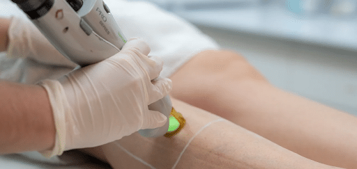 Lasers médicaux et expertise en médecine esthétique à Rouen